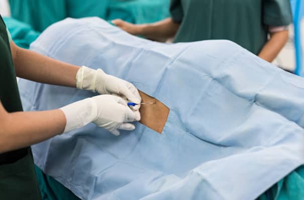 spinal anesthesia